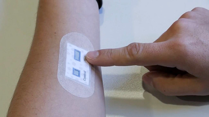 Un nou pegat per a la pell facilita el diagnòstic de la fibrosi quística